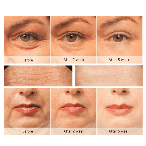 38686 Массажер для кожи вокруг глаз против морщин Eye Anti-Wrinkle Beauty Star  - Вид №3