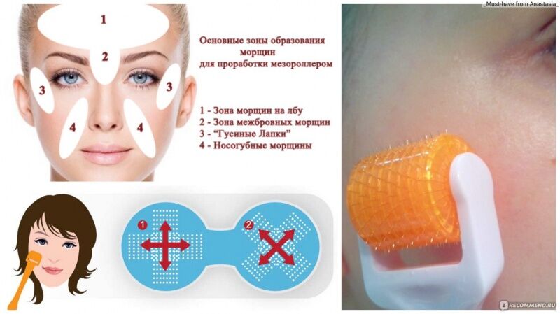 52643 Дермароллер DRS System 6 в 1 ( для глаз, лица, тела, головы) c титановым напылением Beauty Star  - Вид №3