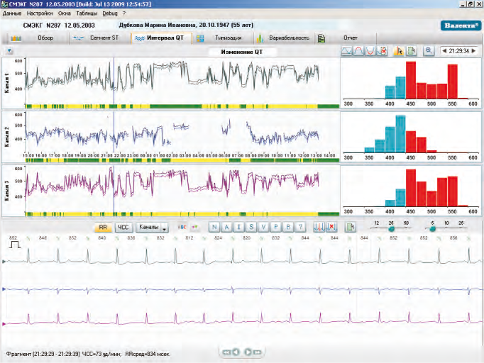 Холтер ЭКГ Валента 12-ти канальный Santreyd MED-37 - Вид №3