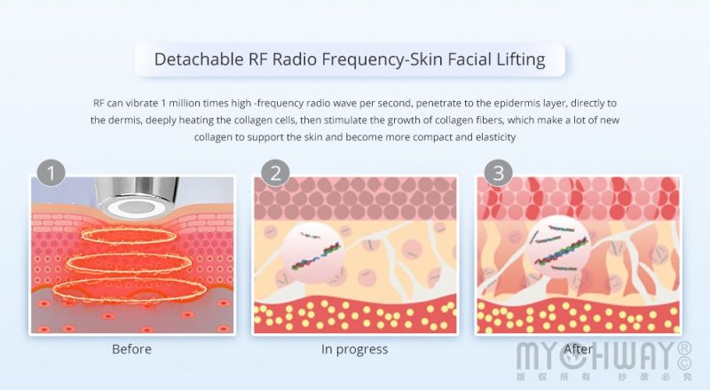 37906 Аппарат RF лифтинга для лица (4 в 1) 11Y3 Mychway  - Вид №11