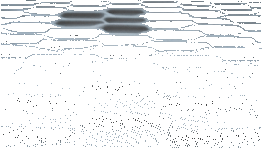 Casalis Акустическая стеновая панель из trevira® cs sun-id-1409543 - Вид №6