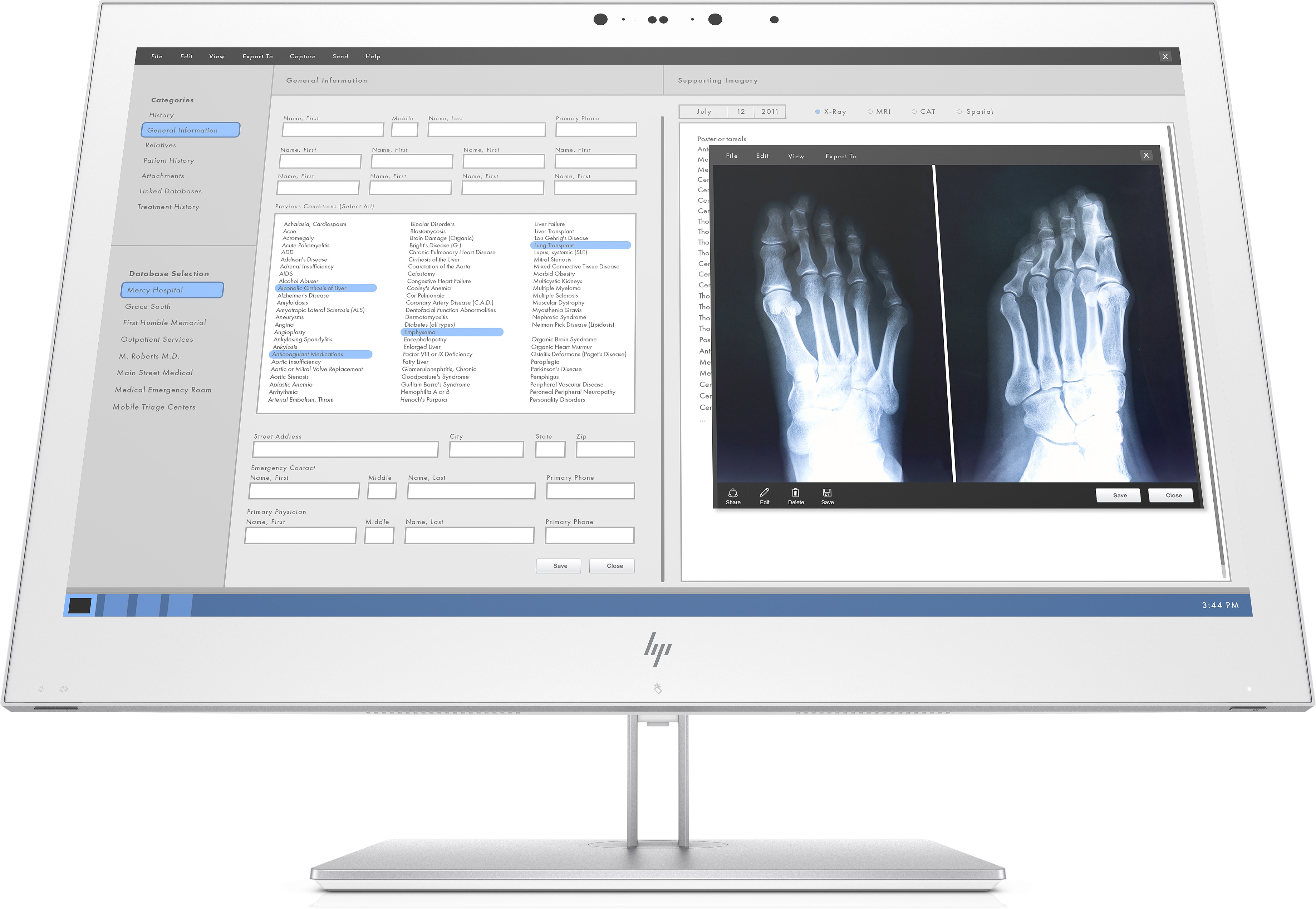 1QW03AA#ABB healthcare edition hc270cr qhd clinical review monitor 350 cd/m2 1000:1 12ms 178°/178° vga hdmi dp 2560x1440 led backlight swivel tilt pivot HP Santreyd  - Вид №1